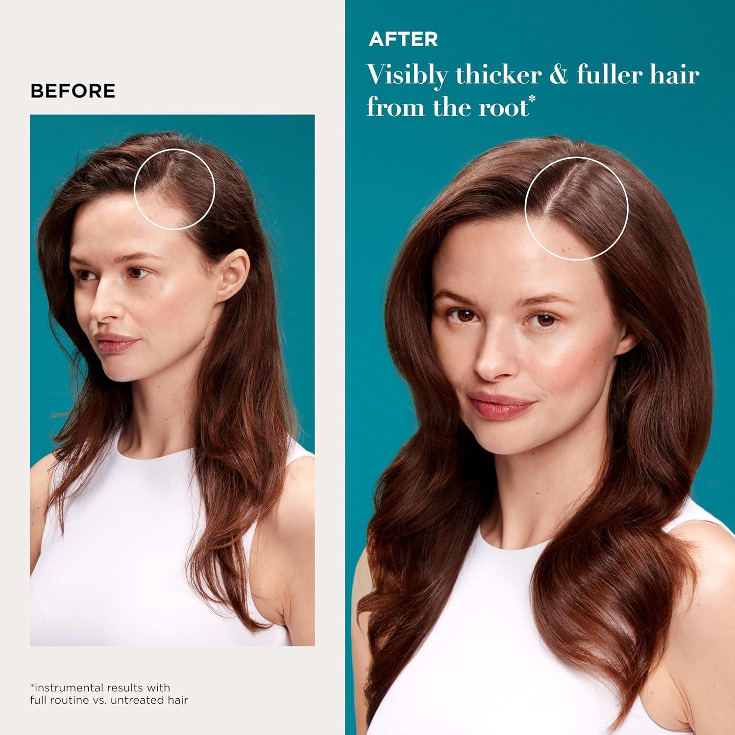 image:imageOGX ProGrowth Peptide Scalp Serum Strengthens amp Densifies by Hydrating the Scalp and Reinforcing Roots to Support Natural Hair Growth 033 fl oz