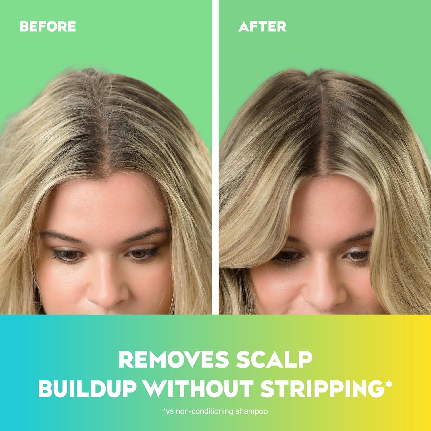 image:imageOGX Extra Strength Refreshing Scalp Rosemary Mint Conditioner Nourishing Hair amp Scalp Conditioner Infused with Rosemary for HealthyLooking Hair SulfateFree Surfactants 254 fl ozTea Tree MintOld